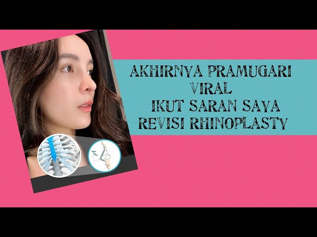 Revisi Rhinoplasty Pramugari Viral | Olivia Rachelina Hans class=