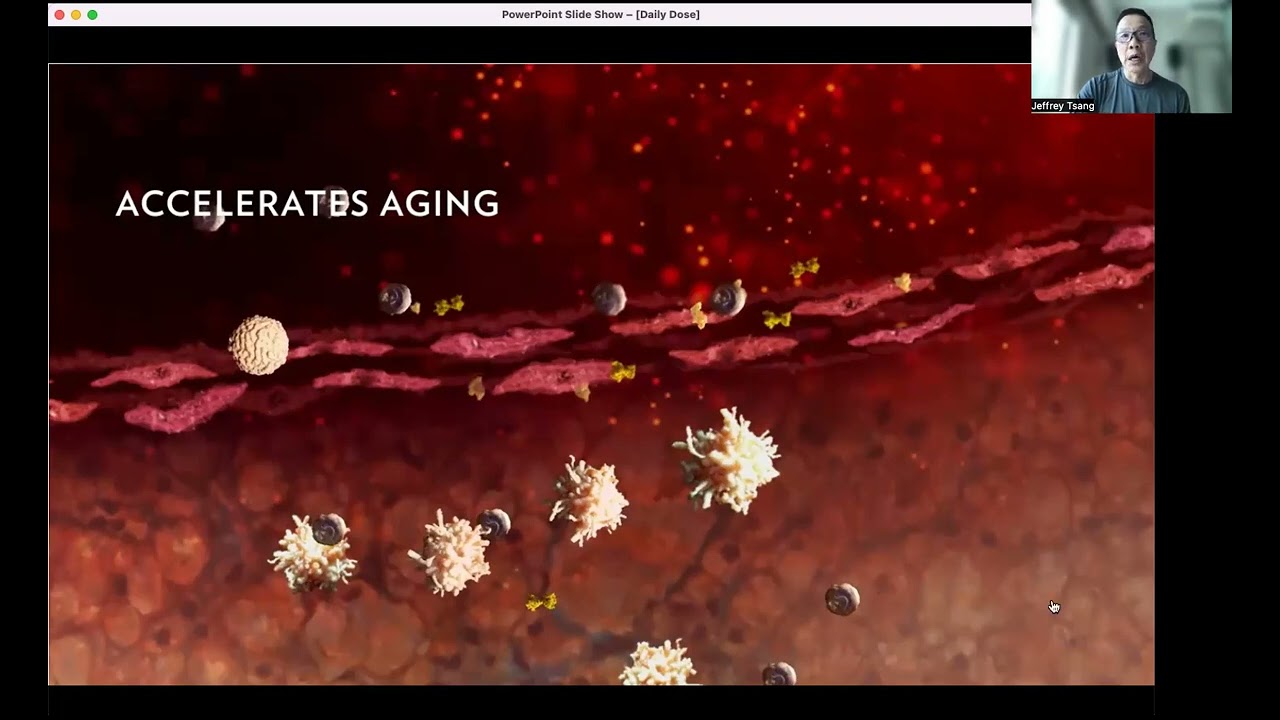 Brain Fog post-Covid