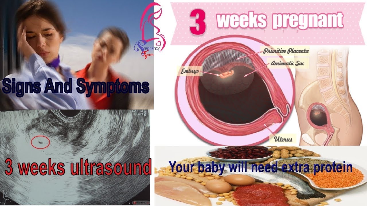 3 weeks pregnant and 3 weeks pregnant Signs And Symptoms 3 weeks