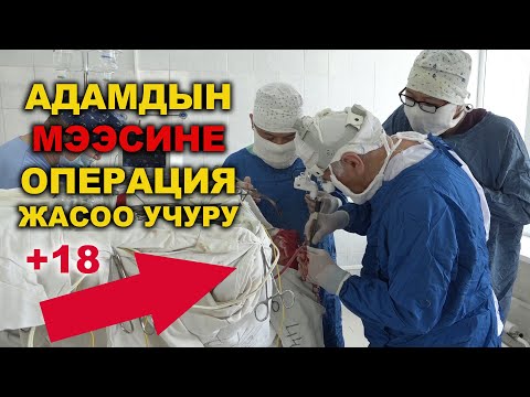 Video: Интубацияны кандай врач жасайт?