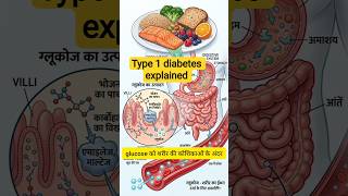 टाइप 1 डायबिटीज क्या है? (Type 1 Diabetes Explained)#shortvideo