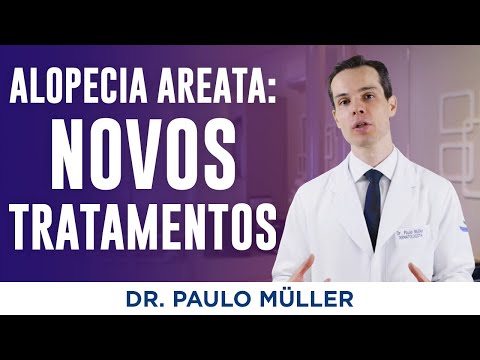 Alopecia Areata: Novos Tratamentos - Dr. Paulo Müller Dermatologista