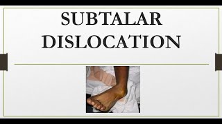 Subtalar Dislocation: Causes, Diagnosis, Imaging, and Treatment Explained