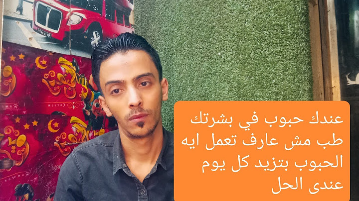 حل سحري للقضاء علي حب الشباب