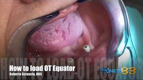 How to Load Ot Equator Rhein83 DDS Roberto Scrascia