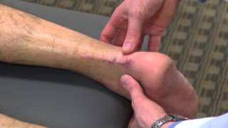 Achilles tendon heals faster with new surgical procedure | Ohio State Medical Center