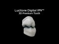 Dentsply sirona lucitone digital print denture lab benefits