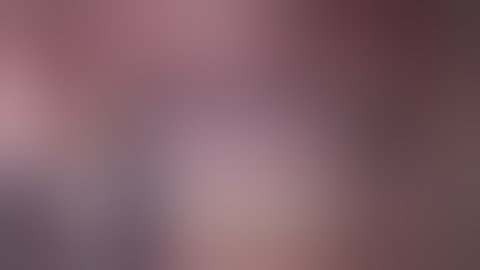 Full Arch Maxilla Restoration using Zygomatic Implants | by Dr. David Zelig