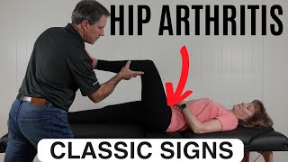 Classic Signs of Hip Arthritis
