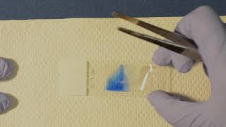 How to prepare a Scotch tape slide for fungal micromorphology assessment