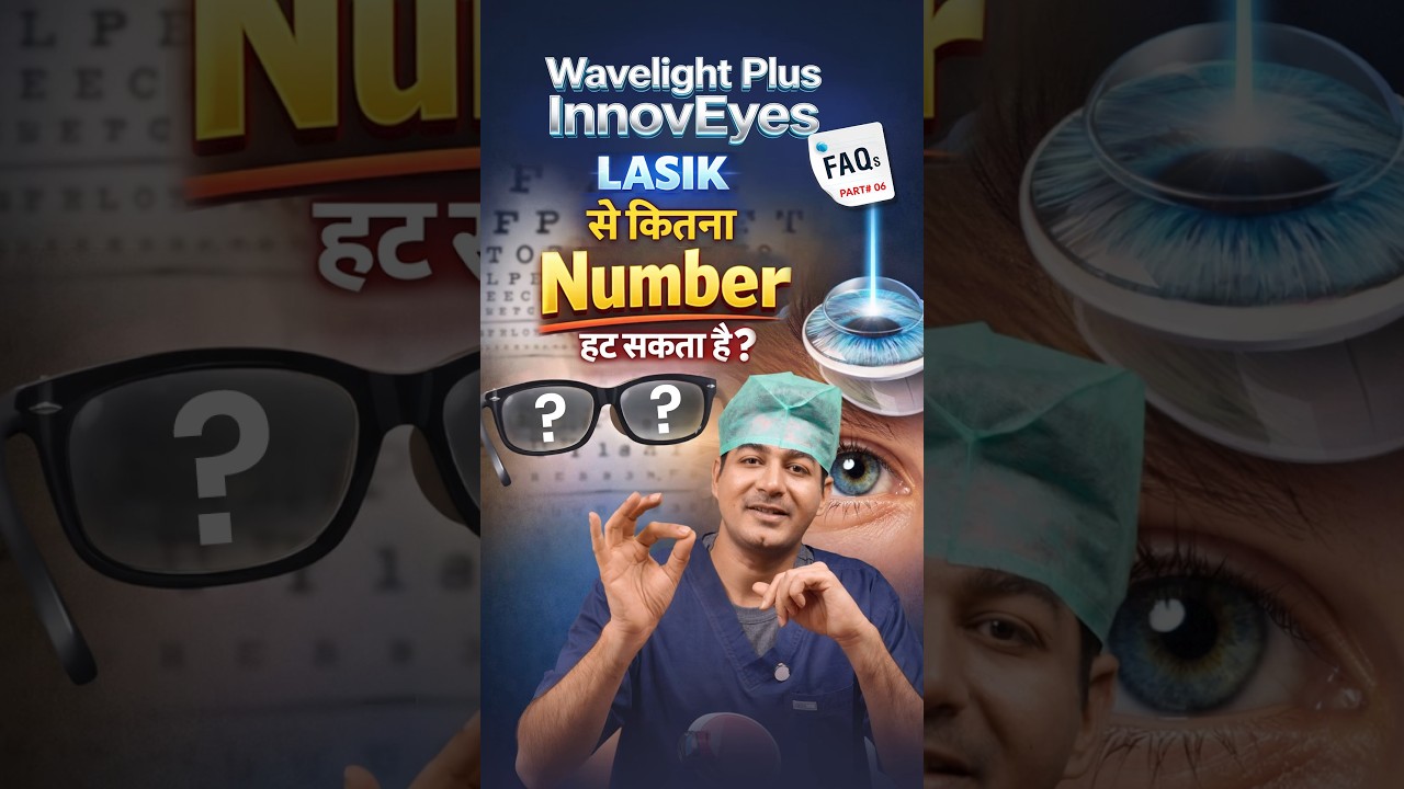 LASIK से कितने नंबर का चश्मा हट सकता है? Wavelight Plus InnovEyes