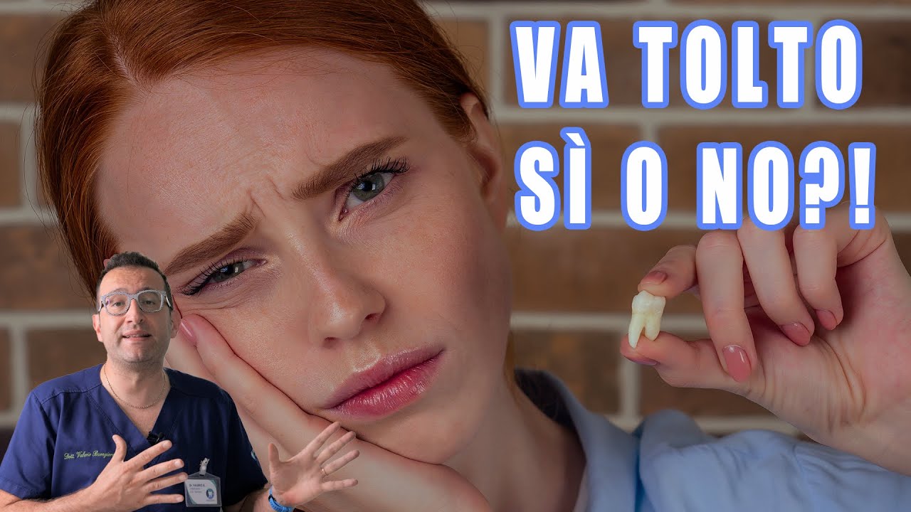 Dente del Giudizio: Togliere o non togliere?