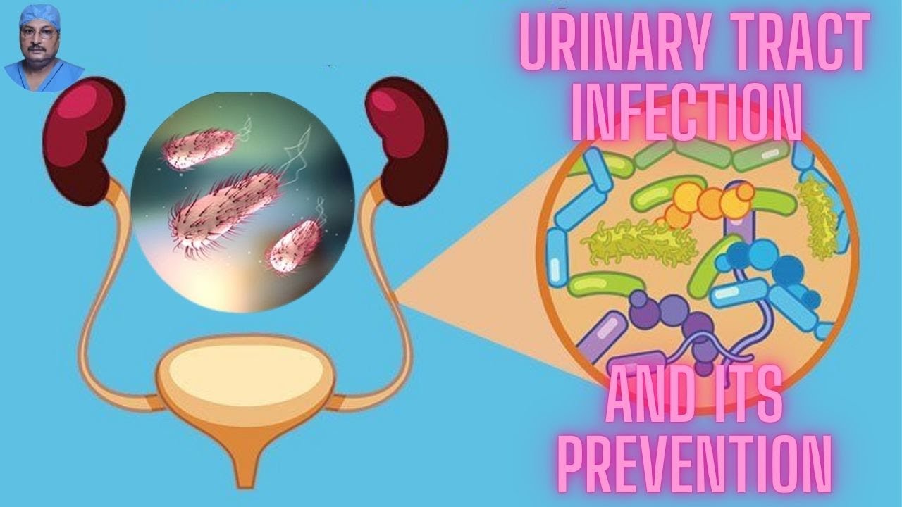 Urinary tract infection and it's prevention by Dr alok kumar moulik in