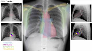 Anatomy of a Chest XRay