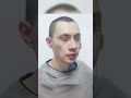 山西小哥颧骨内推+下颌角+下巴九个月反馈，变化太明显。 #beautiful #face #整容 #plastic #shorts