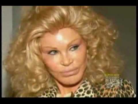 How Much Plastic Surgery did Cat Lady Jocelyn Wild...