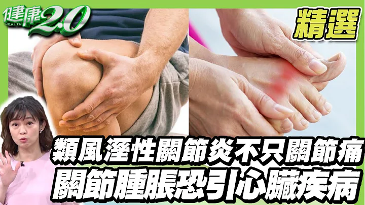 关节肿胀恐引心脏疾病！15%重症肌无力有胸腺瘤 严重恐呼吸衰竭！从脸色看健康！【健康2.0精选】 - 天天要闻