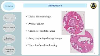 ICCKE 2022 - Weakly Supervised Convolutional Neural Network for Automatic Gleason Grading of Cancer