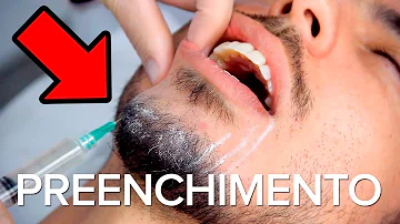 O que é preenchimento de mento?