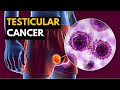 Testicular Cancer, Causes, Signs and Symptoms, Diagnosis and Treatment.