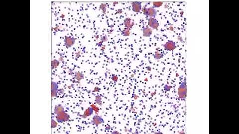 Self-propelled particles