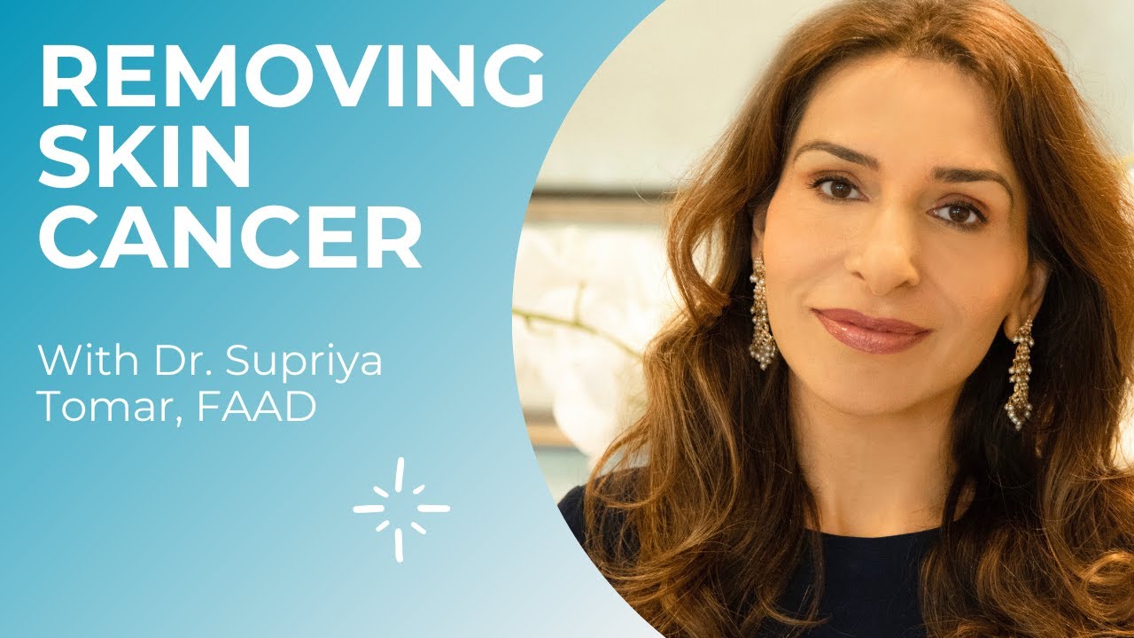 What does removing skin cancer look like? | SKIN CANCER AWARENESS - YouTube