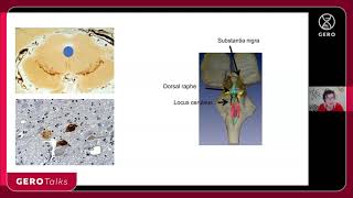 Gero Talk | Lea Grinberg | Rewriting the initial stages of Alzheimer's disease