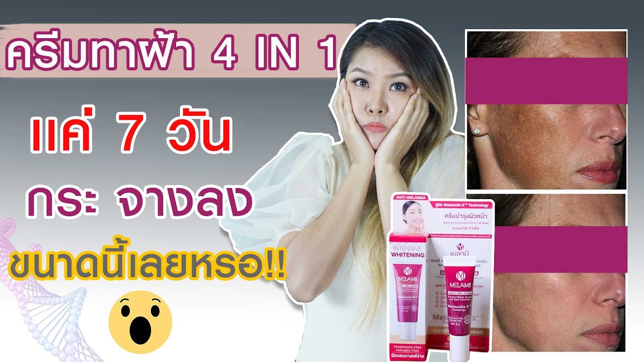 (เช็คสูตร) รีวิว MELAMII ครีมทาฝ้า 4 in 1 แค่ 7 วัน กระจางลงได้ขนาดนี้เลยหรอ? I กูรูยาหม่อง