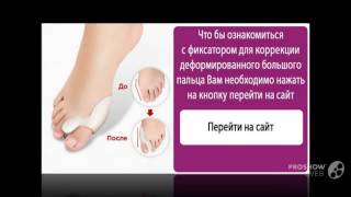 уникальный корректор valgus plus отзывы - Valgus Pro Избавит от косточки уникальный корректор valgus plus отзывы - Valgus Pro Избавит от косточки