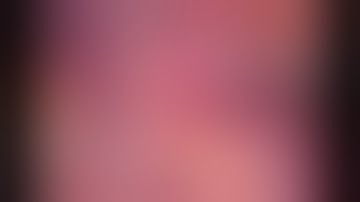 Laparoscopic complete mesocolic excision (CME) - right hemicolectomy