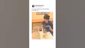 17-Year-Old Creates a Mind-Controlled Prosthetic Arm 🦾🤯