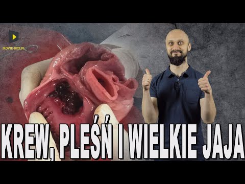 Krew, pleśń i wielkie jaja - przełomy w medycynie. Historia Bez Cenzury