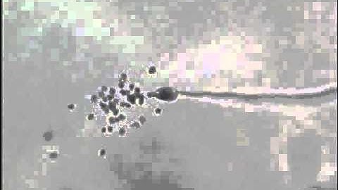 Zoospore Discharge in Phytophthora sojae