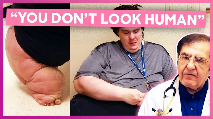 Dr. Now's HARSH Reaction To A 750-lb Patient Addicted To Pills And Food | My 600-lb Life