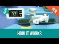 Mazor X - Robotic Assisted Spine Surgery (How it Works)