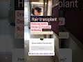 Hair transplant at Punjabi Bagh