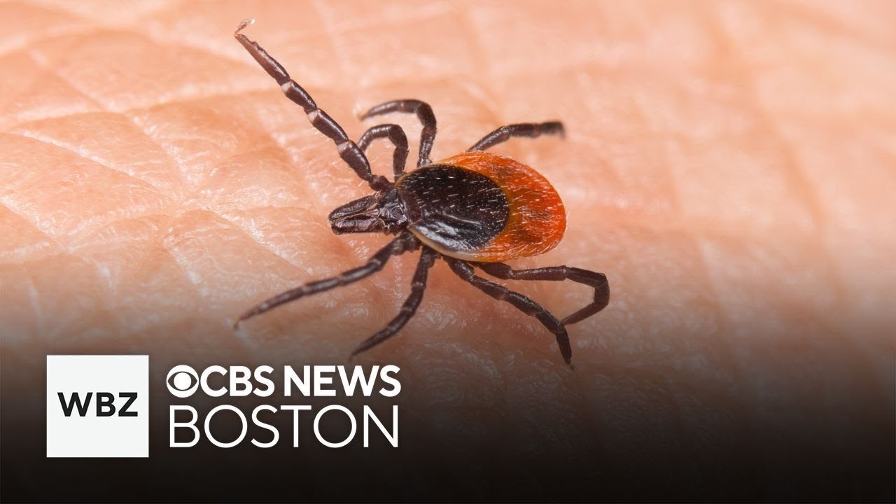 ER visits for tick bites in Northeast at highest level in 5
