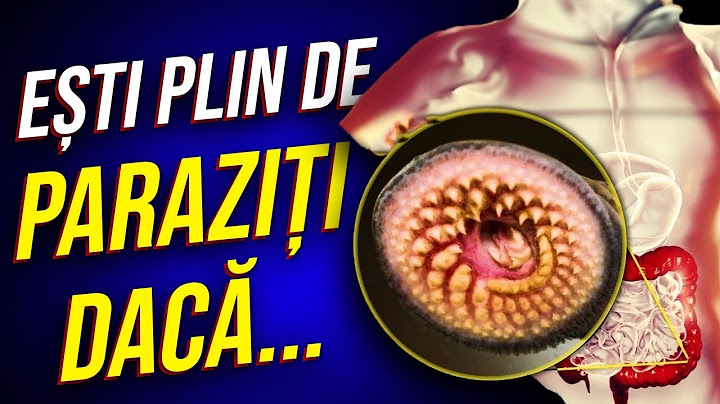 7 Simtome care apar când Ești Plin de PARAZIȚI
