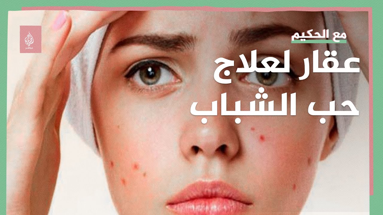 بريطانيا تقيد استخدام عقار لعلاج حب الشباب.. آثاره الجانبية تسبب الانتحار!