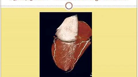 MRI and CT. What is the difference?