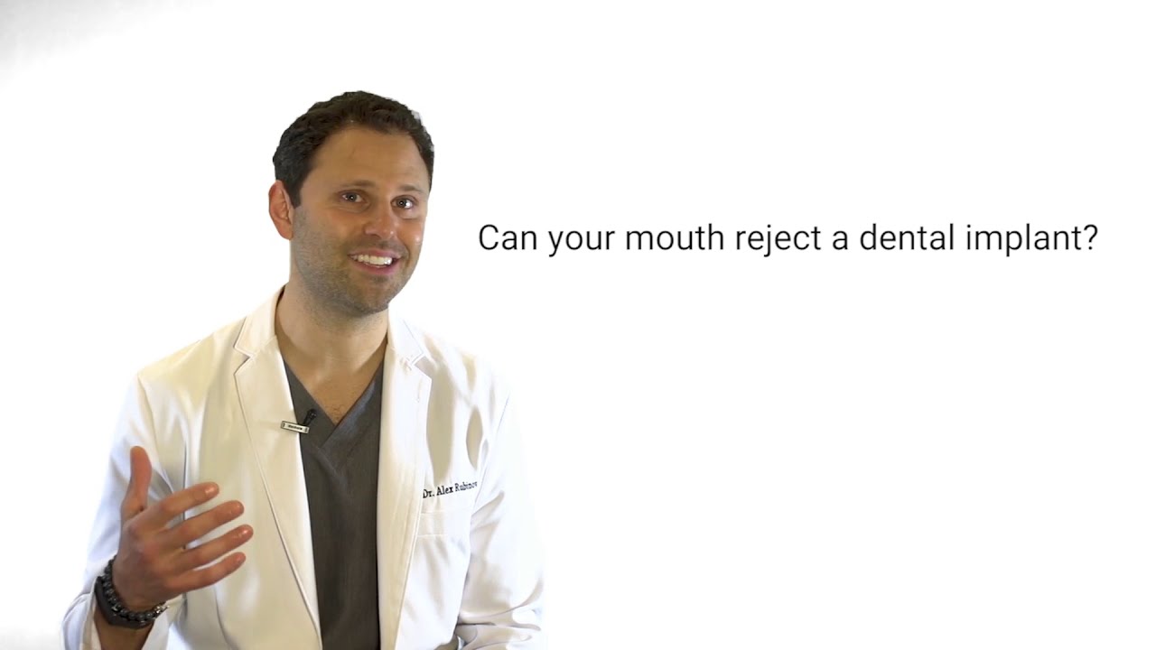 Can Your Mouth Reject a Dental Implant Dr. Alex Rubinov Cosmetic