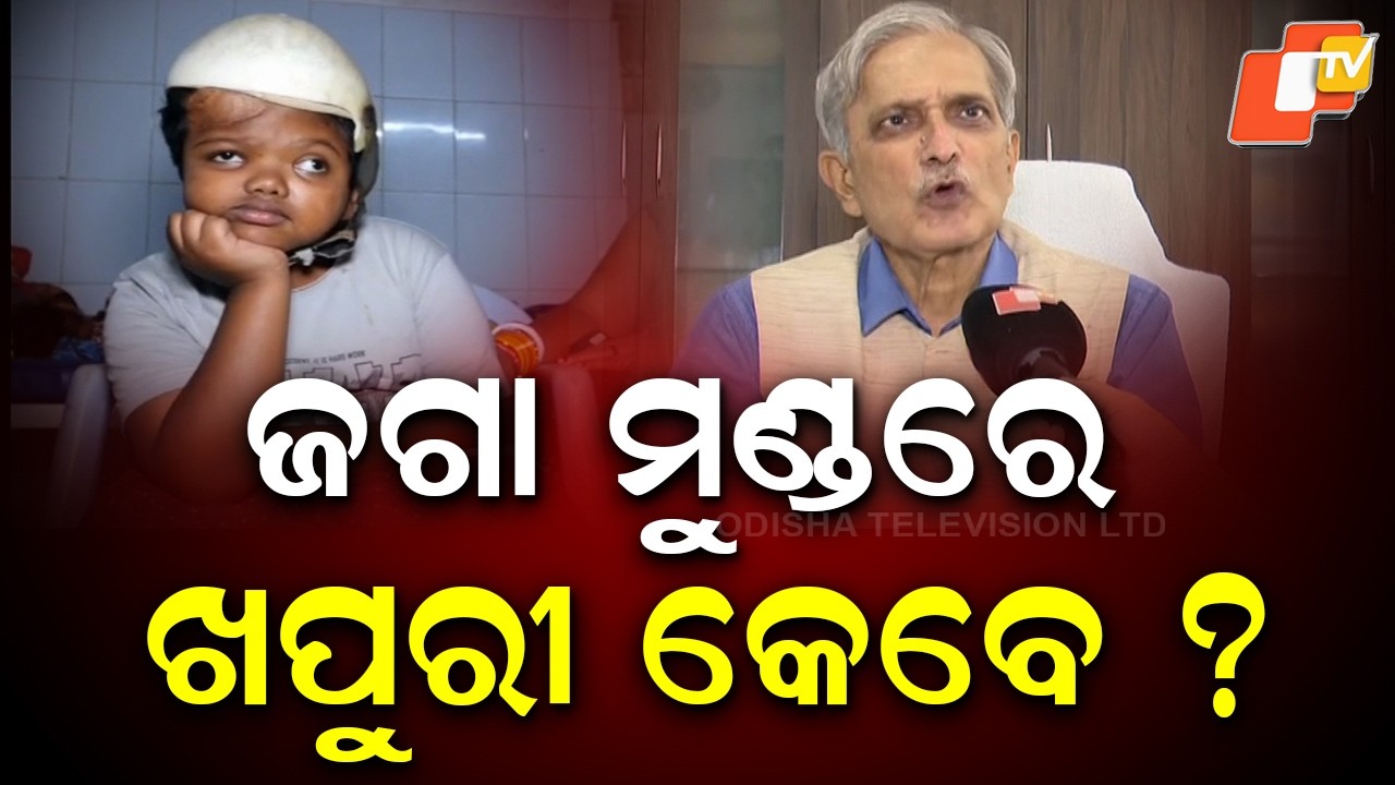 Dr Ashok Mahapatra Recommends Second Operation for Conjoined Twin Jaga