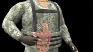 Your Brain and Blast Injuries