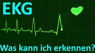 Was erkennt man beim EKG Monitoring (3-Kanal)?