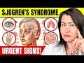 10 vital signs of sjogrens syndrome you cant ignore