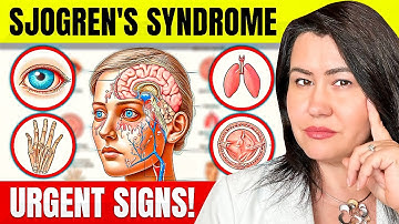 10 URGENT SIGNS of SJOGREN
