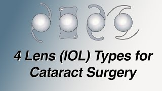 4 Main Lens (IOL) Types for Cataract Surgery: Pros and Cons (Basic Version) screenshot 3