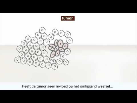 Video: Cyste Versus Tumor: Verschillen, Kanker, Diagnose En Behandeling