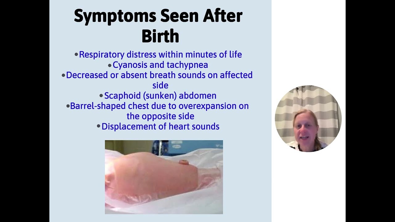 Congenital Diaphragmatic Hernia