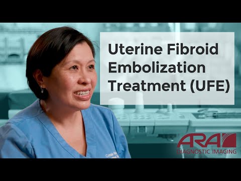 Uterine Fibroid Embolization Treatment  (UFE) - ARA Diagnostic Imaging